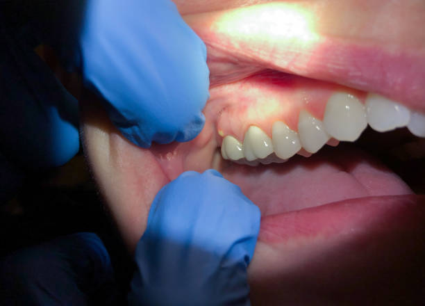 Best Emergency Dental Services for Seniors in Wade Hampton, SC